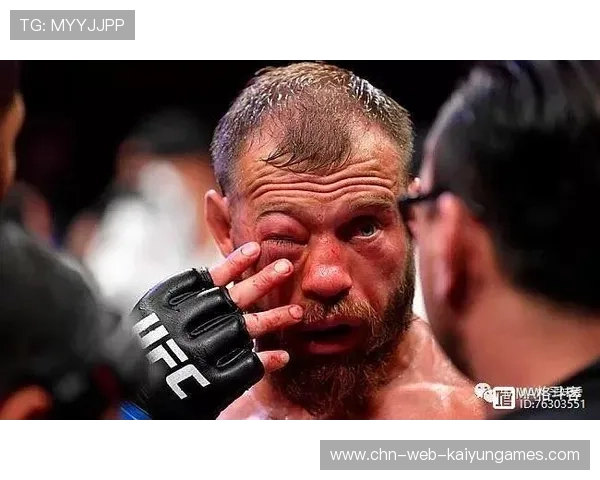 UFC肘击命中瞬间,现场音效震撼到刺激神经